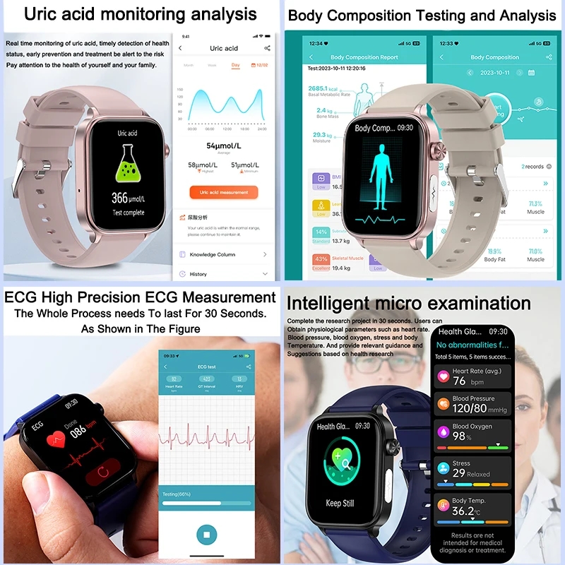 2025 New For XIAOM1 ECG+PPG Bl - Smartwatch Health Watches For Women review and price